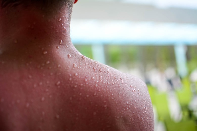 7 Reasons to Own an Infrared Sauna Blanket 3